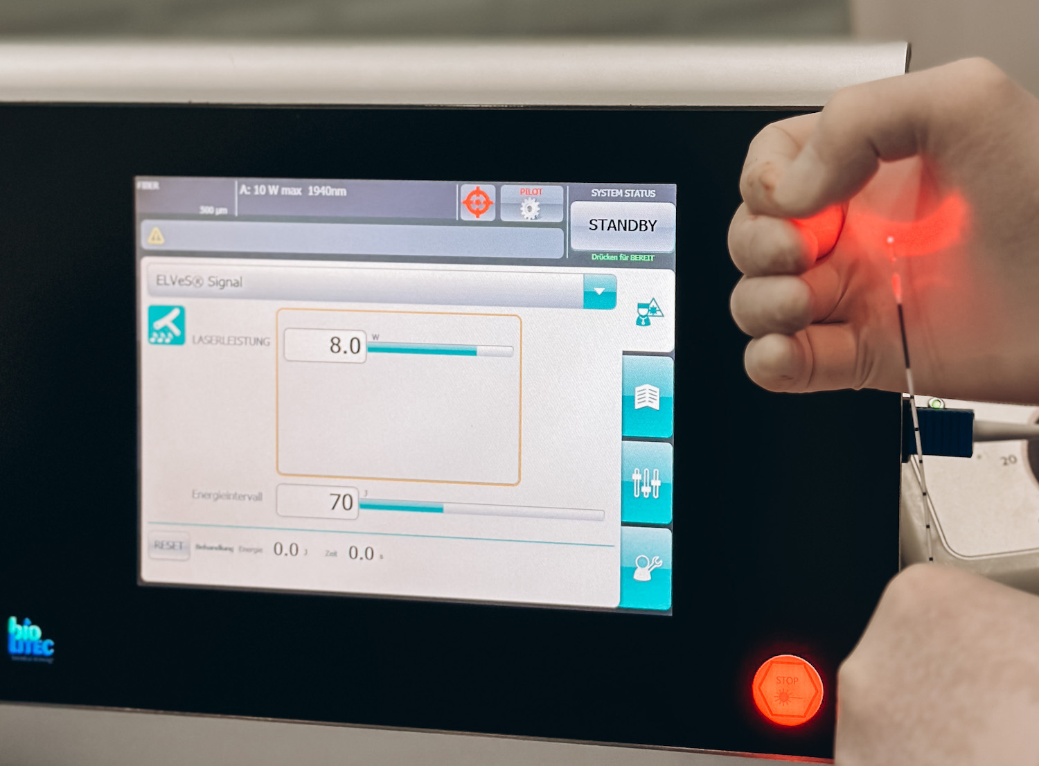 Лечение варикоза на аппарате Biolitec